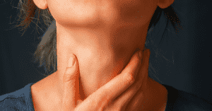 Swollen lymph nodes under jaw