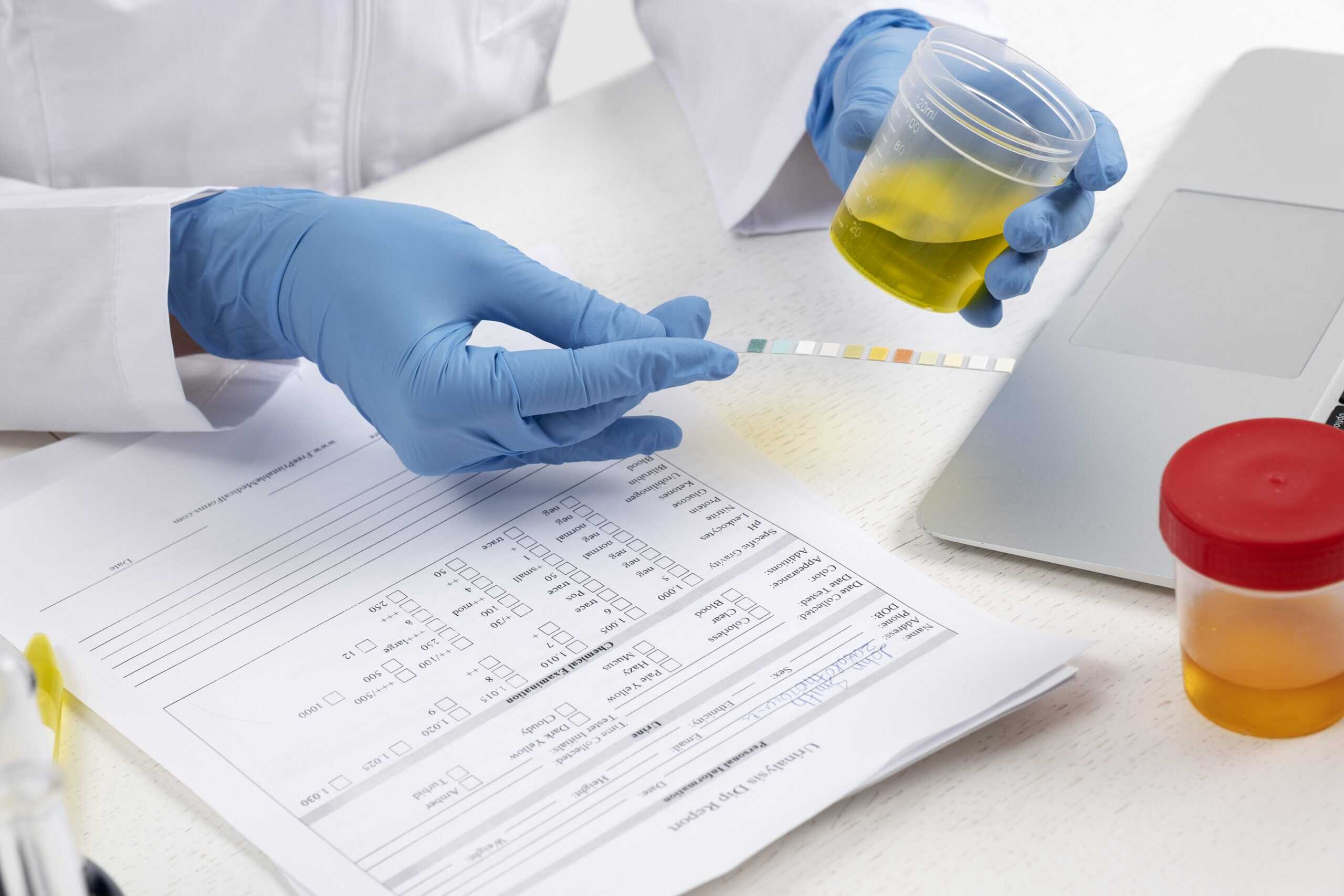 Leukocytes in urine