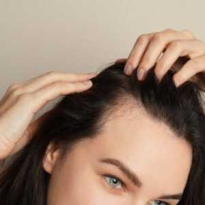 Baldness Treatment Online