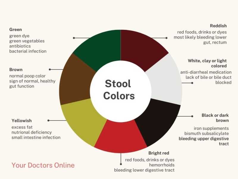 melanotic stools What Causes Black or Tarry Stool? Colonoscopy images showing the presence