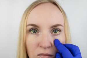 Jaundice treatment