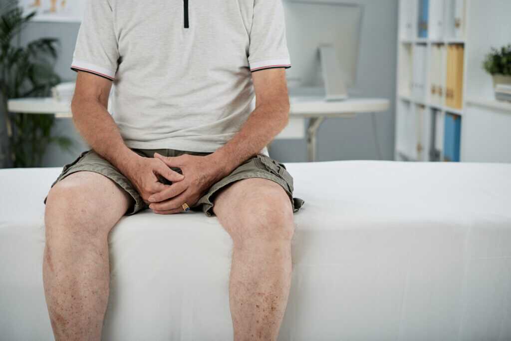 Anal Yeast Infection