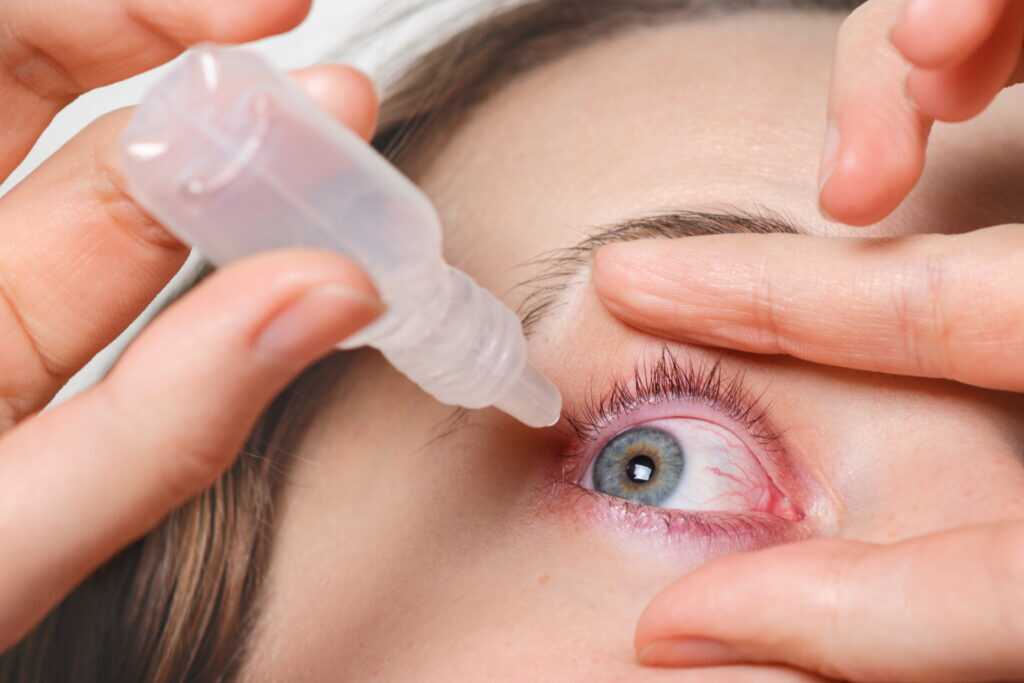 shingles in your eye