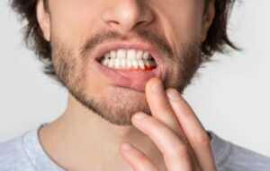 amoxicillin for tooth infection