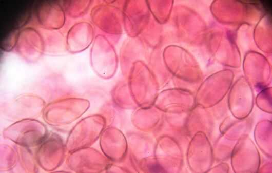 liver fluke under light microscopy