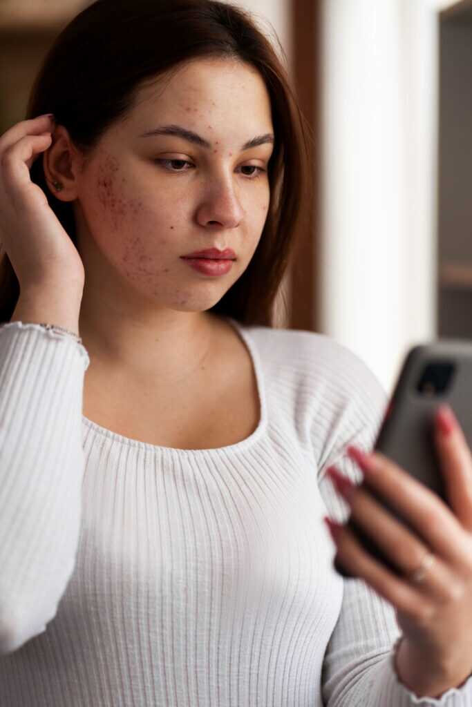 Accutane prescription online